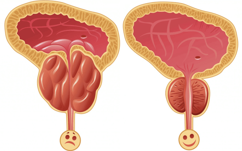Causas dos problemas de potencia nos homes